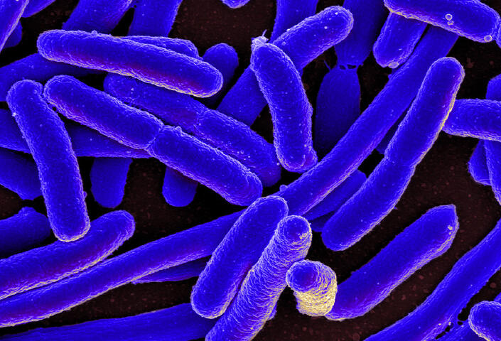 Scanning electron micrograph of Escherichia coli