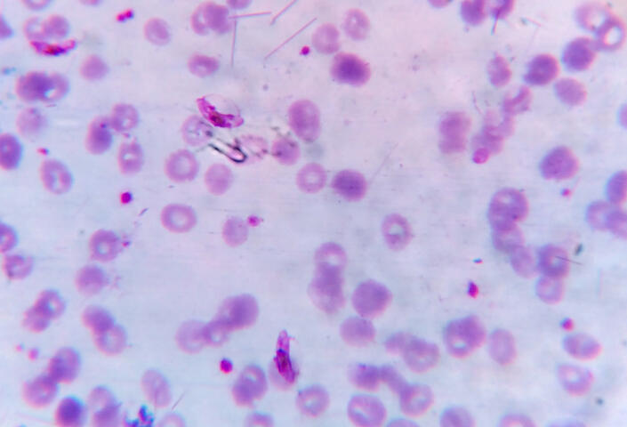 Plasmodium falciparum bacteria