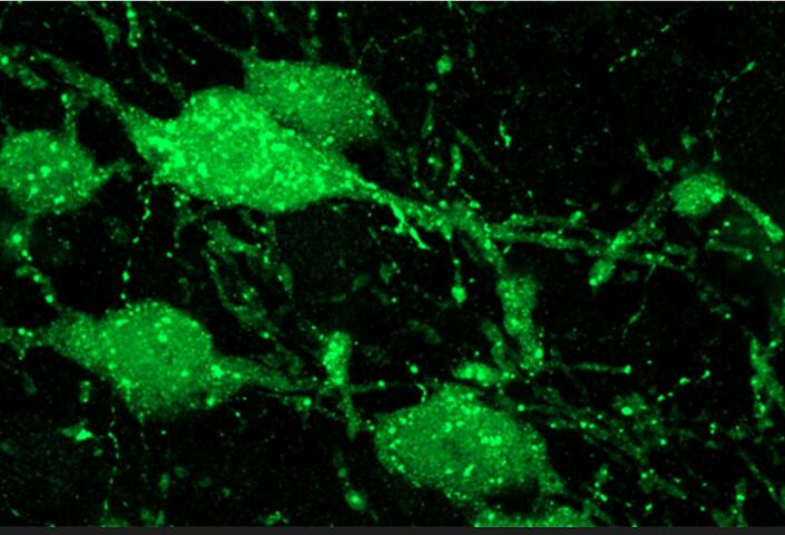 Seratonin glows green in a microscope image of cells in a mouse brain stem