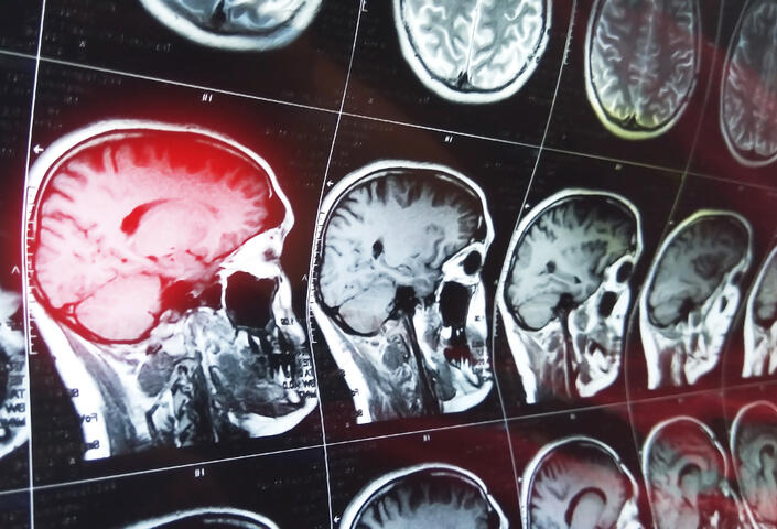 MRI head scan on dark background blue color