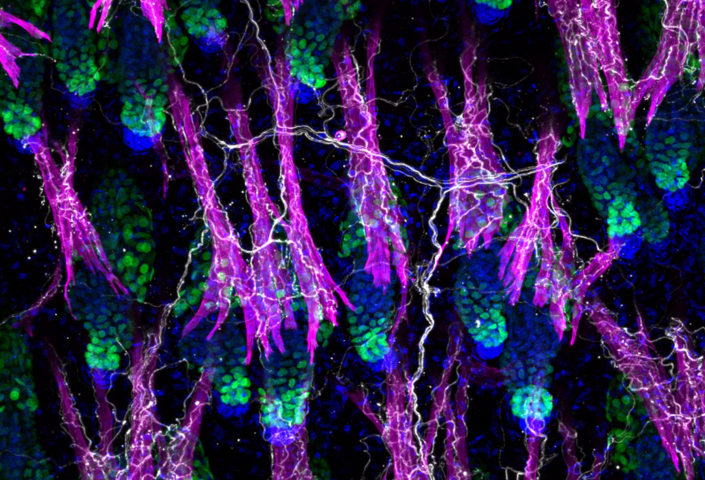 Immunofluorescence image of the skin