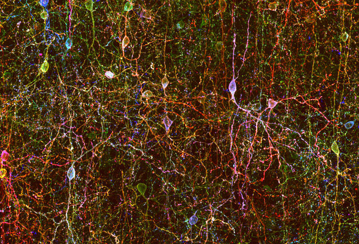 VIP neurons in mouse auditory cortex labeled using Brainbow technology
