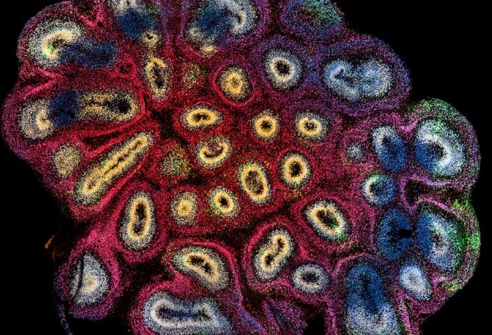 photo of an organoid cell