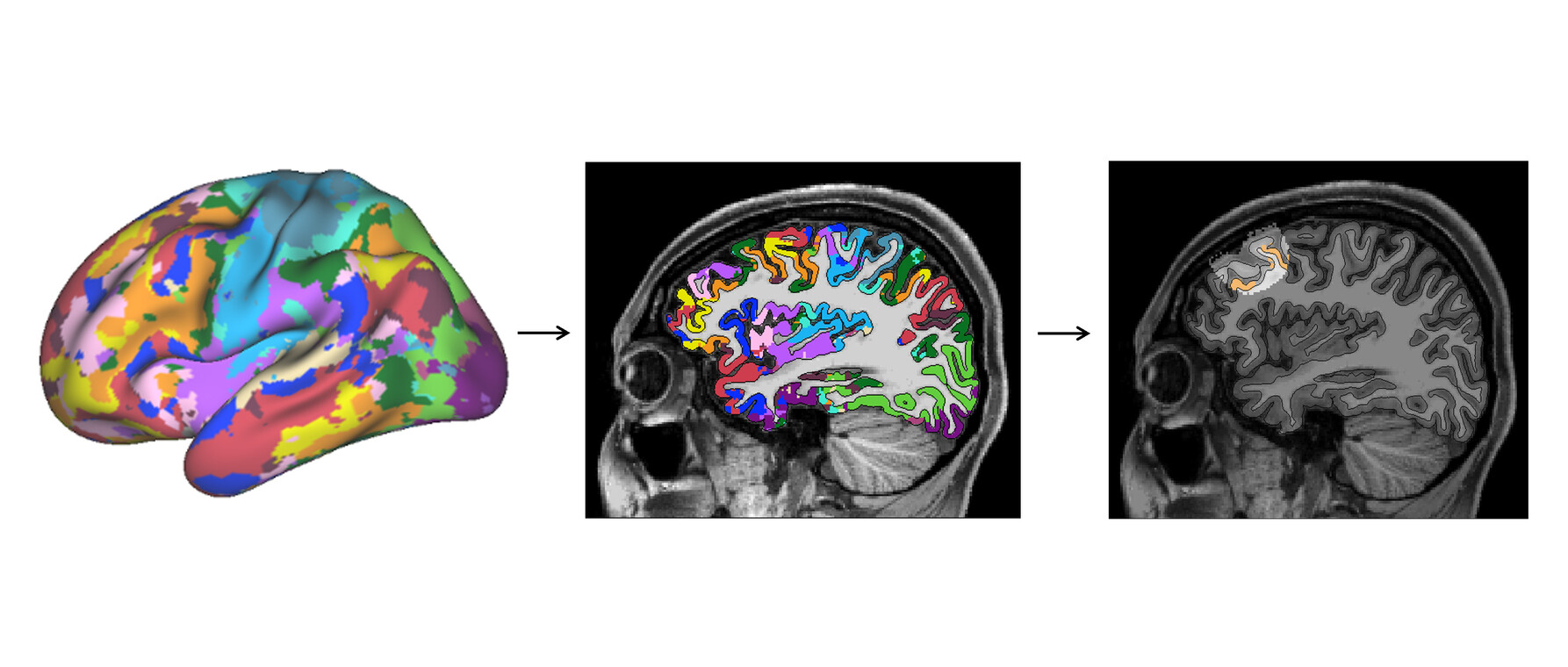 Three pictures showing the phases of brain during research