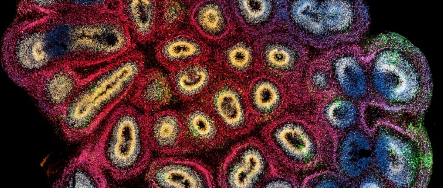 photo of an organoid cell