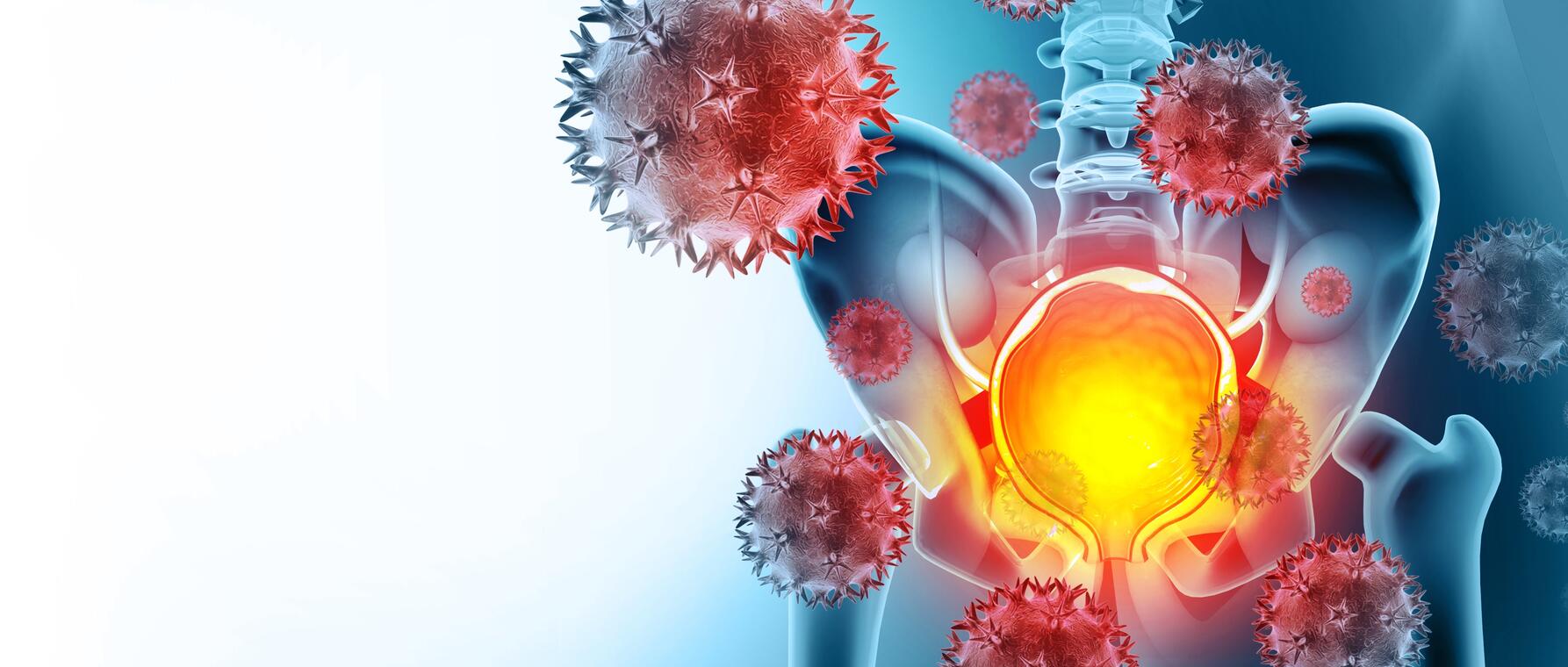 3d illustration of prostate cancer cells
