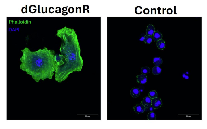 The image shows cells engineered by Muhammad Ahmad to express the glucagon receptor, resulting in distinct changes in cell morphology.