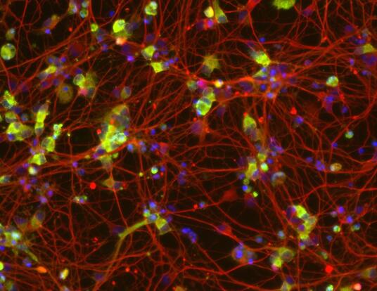 Engineered motor neurons in culture stained to show the ALS-implicated protein TDP-43 (green), the cell body (red) and nuclei (purple)