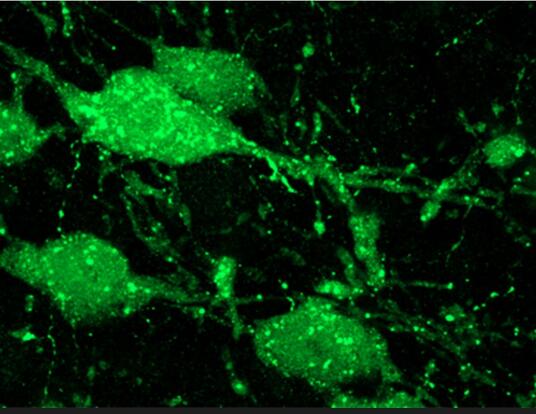 Seratonin glows green in a microscope image of cells in a mouse brain stem
