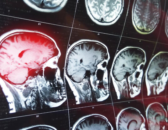 MRI head scan on dark background blue color