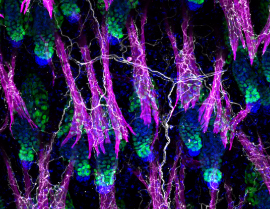 Immunofluorescence image of the skin