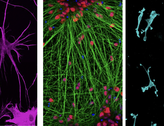 representative immunostaining images of the cell models used to study the mechanism of CLU in human biology