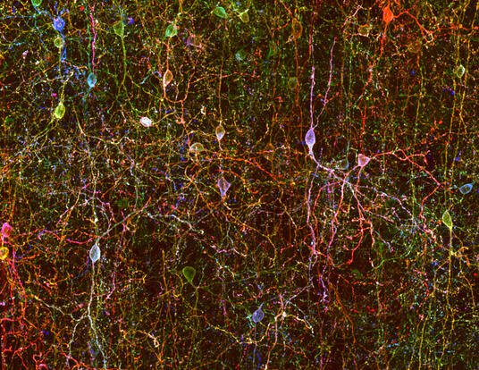 VIP neurons in mouse auditory cortex labeled using Brainbow technology