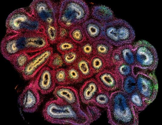 photo of an organoid cell