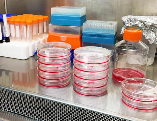 Rhea’s prostate cancer cells in the tissue culture biosafety cabinet in the Cichowski Lab.