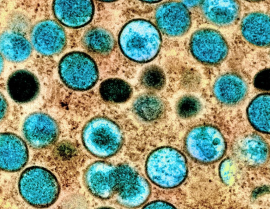 Colorized transmission electron micrograph of monkeypox virus particles (teal) in an infected cell (brown).