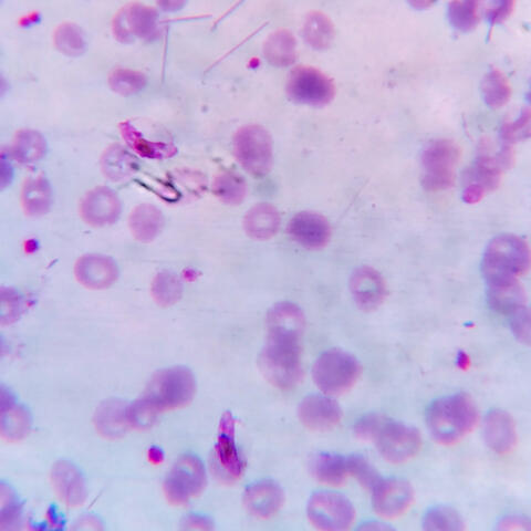 Plasmodium falciparum bacteria