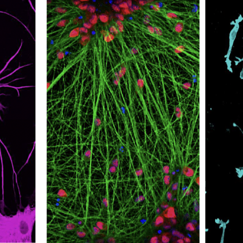 representative immunostaining images of the cell models used to study the mechanism of CLU in human biology