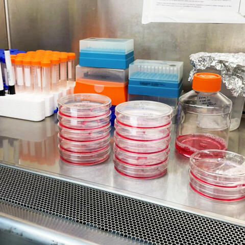 Rhea’s prostate cancer cells in the tissue culture biosafety cabinet in the Cichowski Lab.