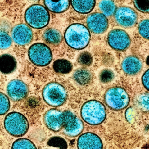 Colorized transmission electron micrograph of monkeypox virus particles (teal) in an infected cell (brown).